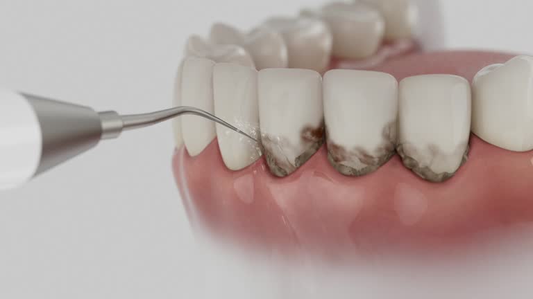 Trusted Wisdom Tooth Removal service in Riverside, UT - Dentist Open Now